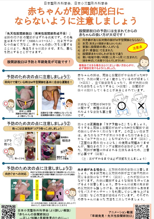 先天性股関節脱臼の診断と治療/メジカルビュ-社/尾崎敏文（単行本） 先天性股関節脱臼の診断と治療 | 尾崎 敏文, 赤澤 啓史 |本